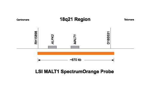 Vysis-LSI-IGH-MALT1-Dual-Color-Dual-Fusion-Probes