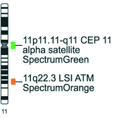 Vysis-LSI-ATM-SpectrumOrange-Vysis-CEP-11-SpectrumGreen-Probes