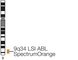 Vysis-LSI-BCR-ABL-Dual-Color-Dual-Fusion-Translocation-Probe