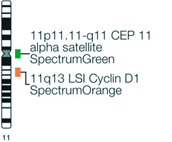 Vysis-LSI-Cyclin-D1-(11q13)-SpectrumOrange-Vysis-CEP-11-SpectrumGreen