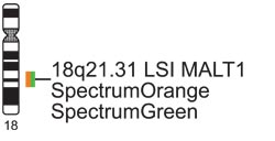 Vysis-LSI-MALT1-Dual-Color-Break-Apart-Rearrangement-Probe