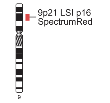Vysis-LSI-9p21-Spectrum-Red-Probe