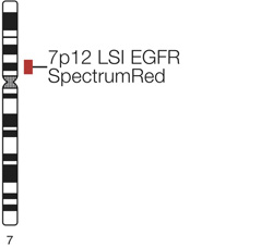 Vysis-LSI-EGFR-SpectrumRed-Probe