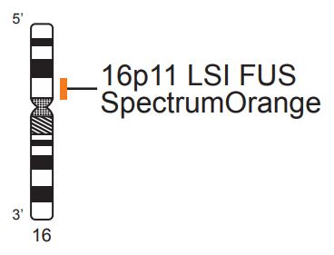 Vysis-LSI-FUS-Cen-SpectrumOrange-Probe