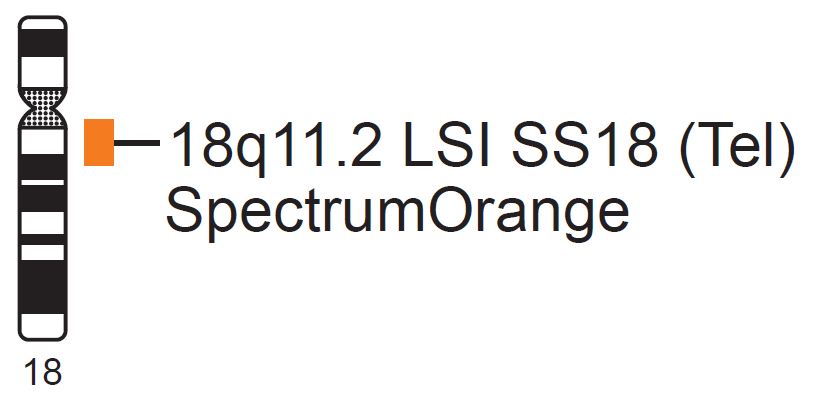 Vysis-LSI-SS18-Tel-SpectrumOrange-Probe