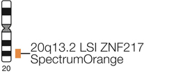 Vysis-LSI-ZNF217-SpectrumGold-SpectrumOrange-Spectrum-Red